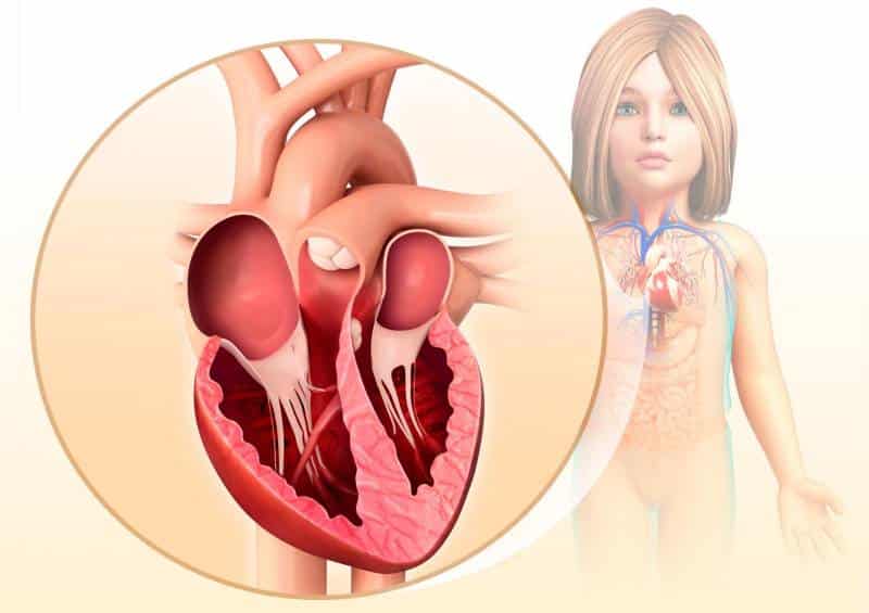 Illustrazione delle camere del cuore di un bambino.